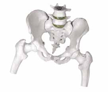 Model of Pelvis with 4th and 5th Lumbar Vertebrae with Femur Heads